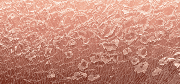 Banish Dryness and Embrace Hydration | Blog | Round Lab