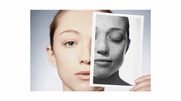 Close-up portrait of a person holding a black-and-white photo highlighting freckles and sun-exposed skin