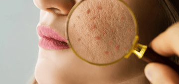 Sensitive Skin Blog Round Lab