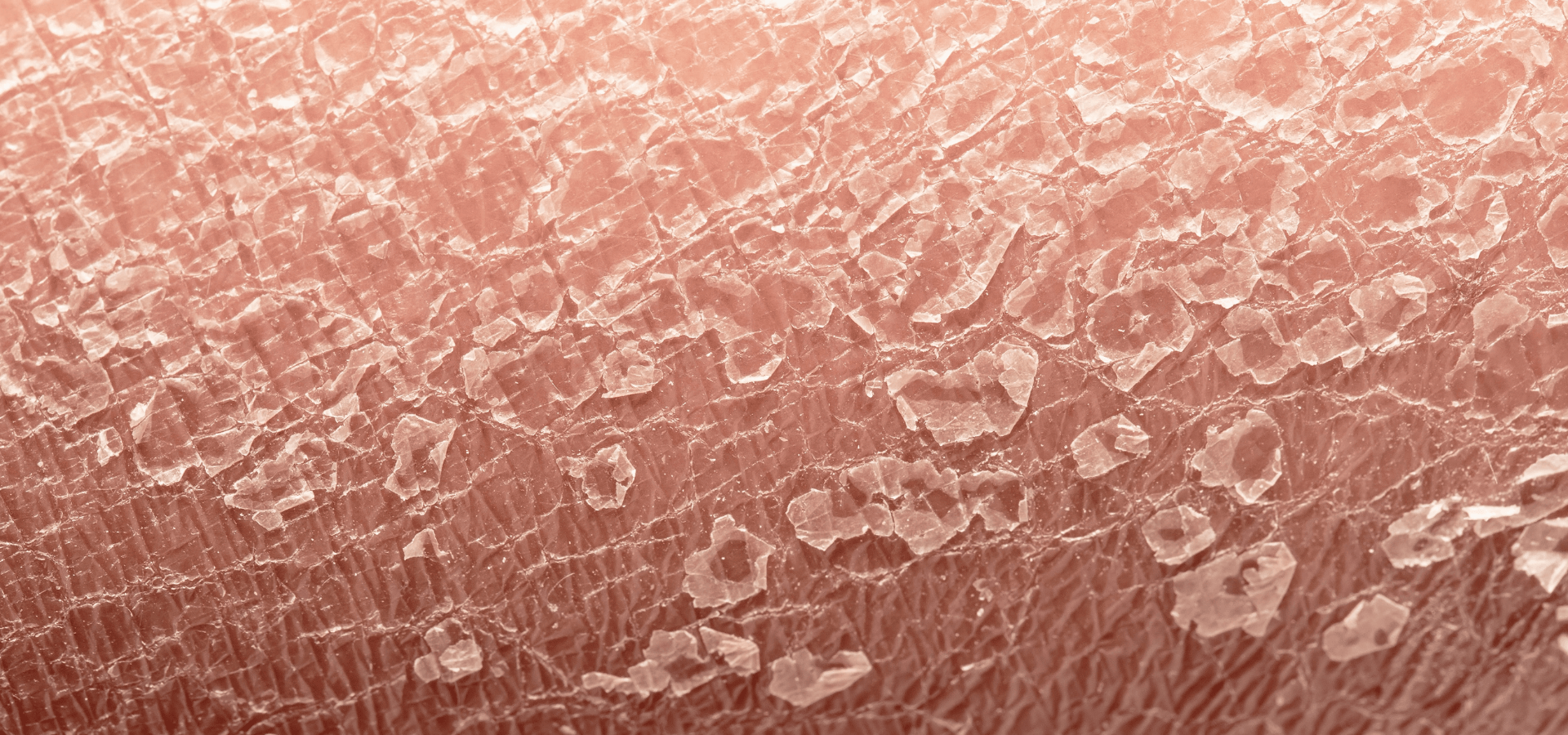 Banish Dryness and Embrace Hydration | Blog | Round Lab