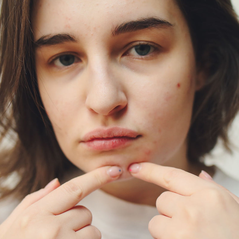 Pores & Oil